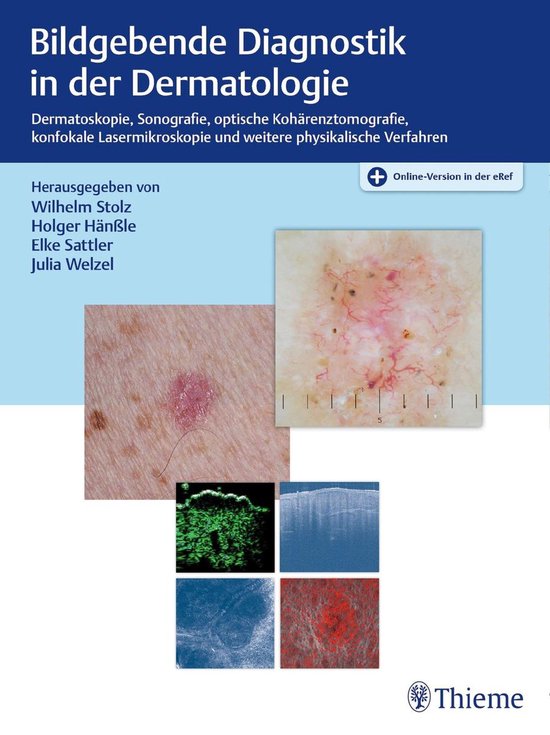 Bildgebende Diagnostik in der DermatologieEbook Dermatoskopie, Konfokale Laserscanmikroskopie, Optische Kohärenztomografie, Sonografie